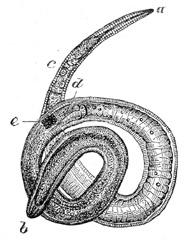 Muskeltrichine